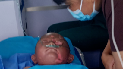 遼寧一家三口因煤氣爆炸嚴(yán)重?zé)齻?></div>
                    <div   id=