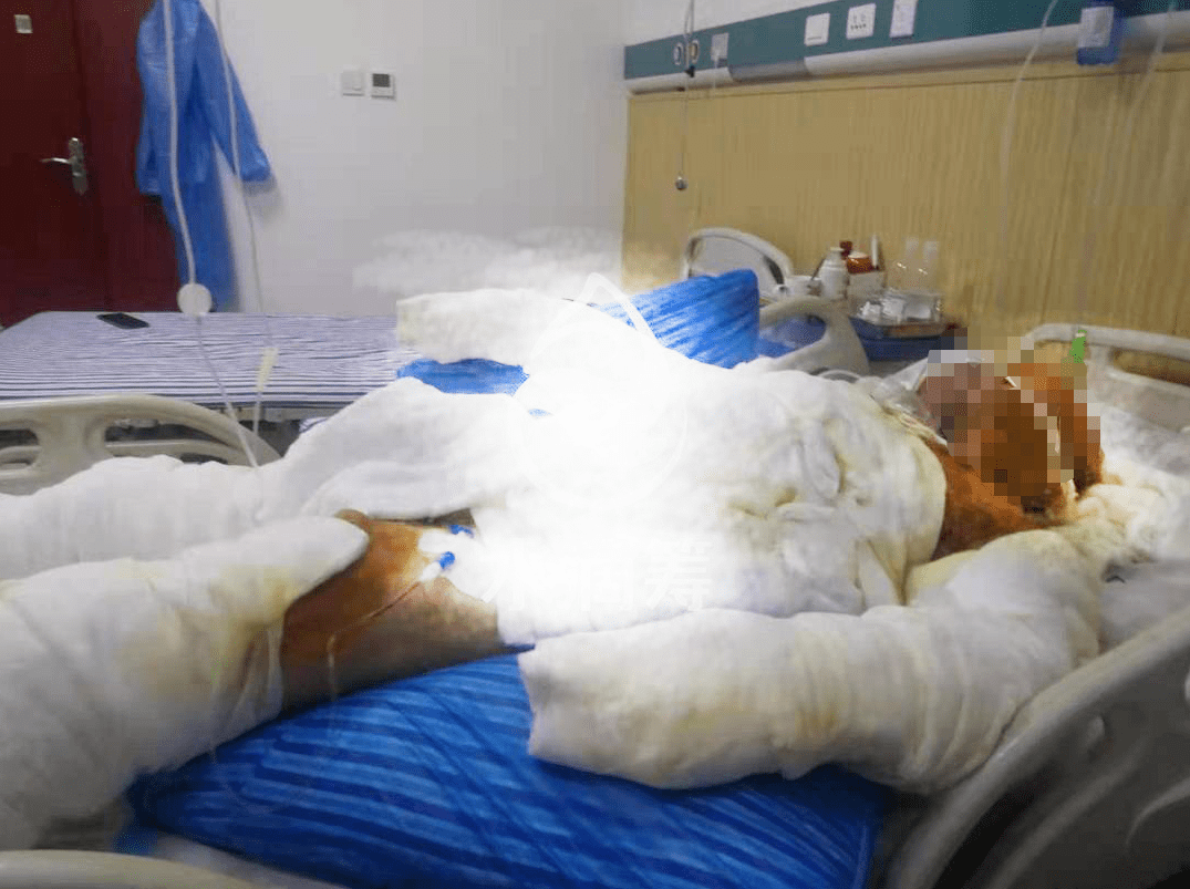 1626398970113083.png bd344e25b6a74a19958429be8c6aea9d.png